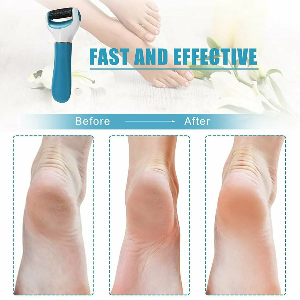 Electronic Dry Foot File Callous Remover For Feet Electric Foot With Roller Hard And Dead Skin- Regular Coarse Baby Smooth Feet In Minutes. For In Home Padicure Foot Care Battery Powered Usb (Battry Not Included)
