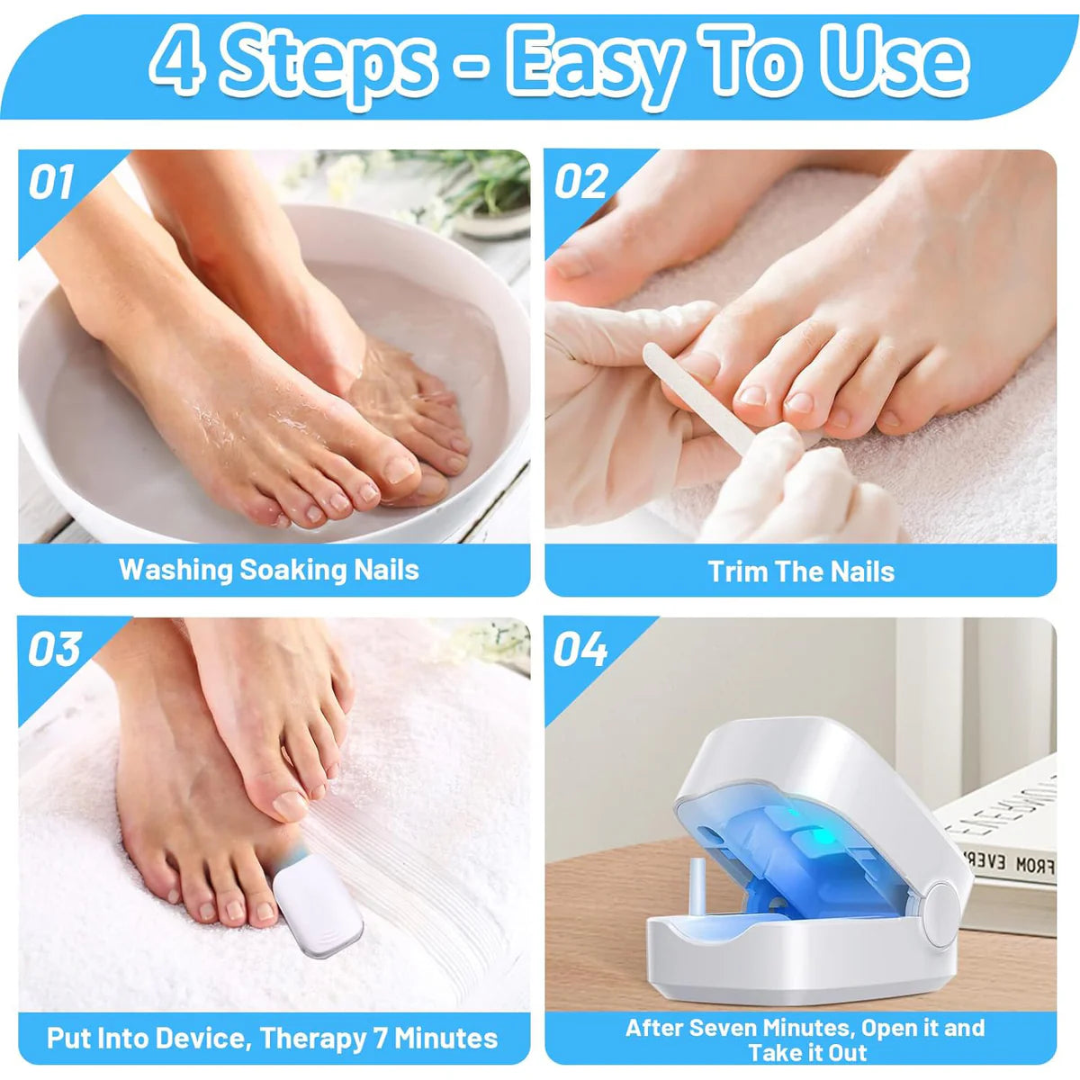 Rechargeable Nail Fungus Treatment For Toenail Toe Nail Fungal Treatment Nail Fungus Laser Device Anti-fungal Nail Treatment For Hand Feet Infections Remover For Home Use