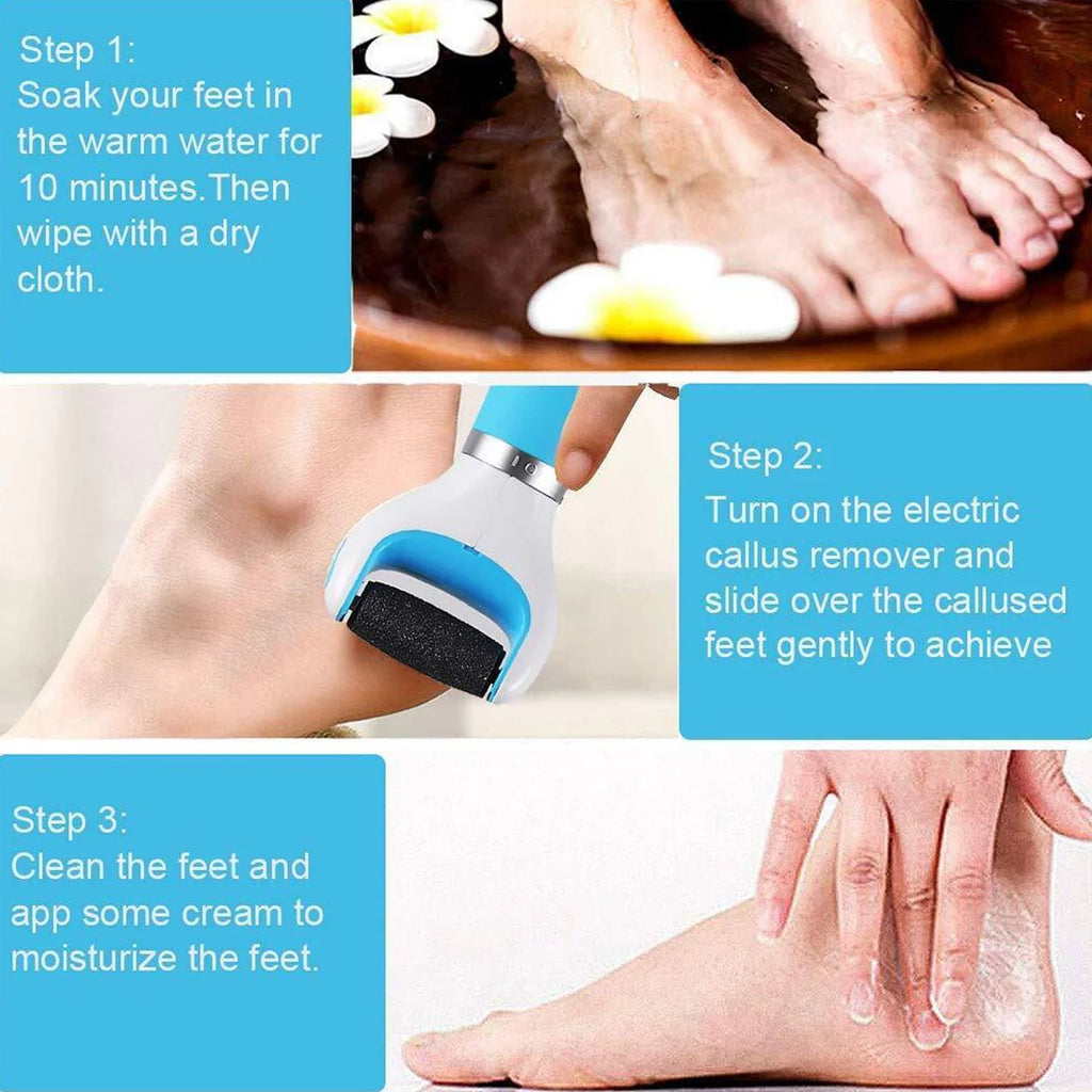 Electronic Dry Foot File Callous Remover For Feet Electric Foot With Roller Hard And Dead Skin- Regular Coarse Baby Smooth Feet In Minutes. For In Home Padicure Foot Care Battery Powered Usb (Battry Not Included)